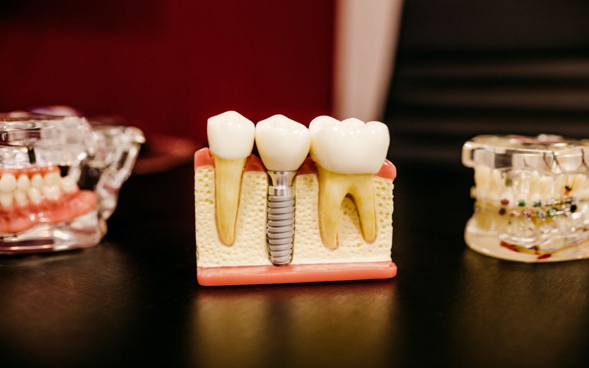 Dişlerin Yeniden Büyümesini Sağlayan Bir İlaç Önümüzdeki On Yıl İçinde Piyasada Olabilir